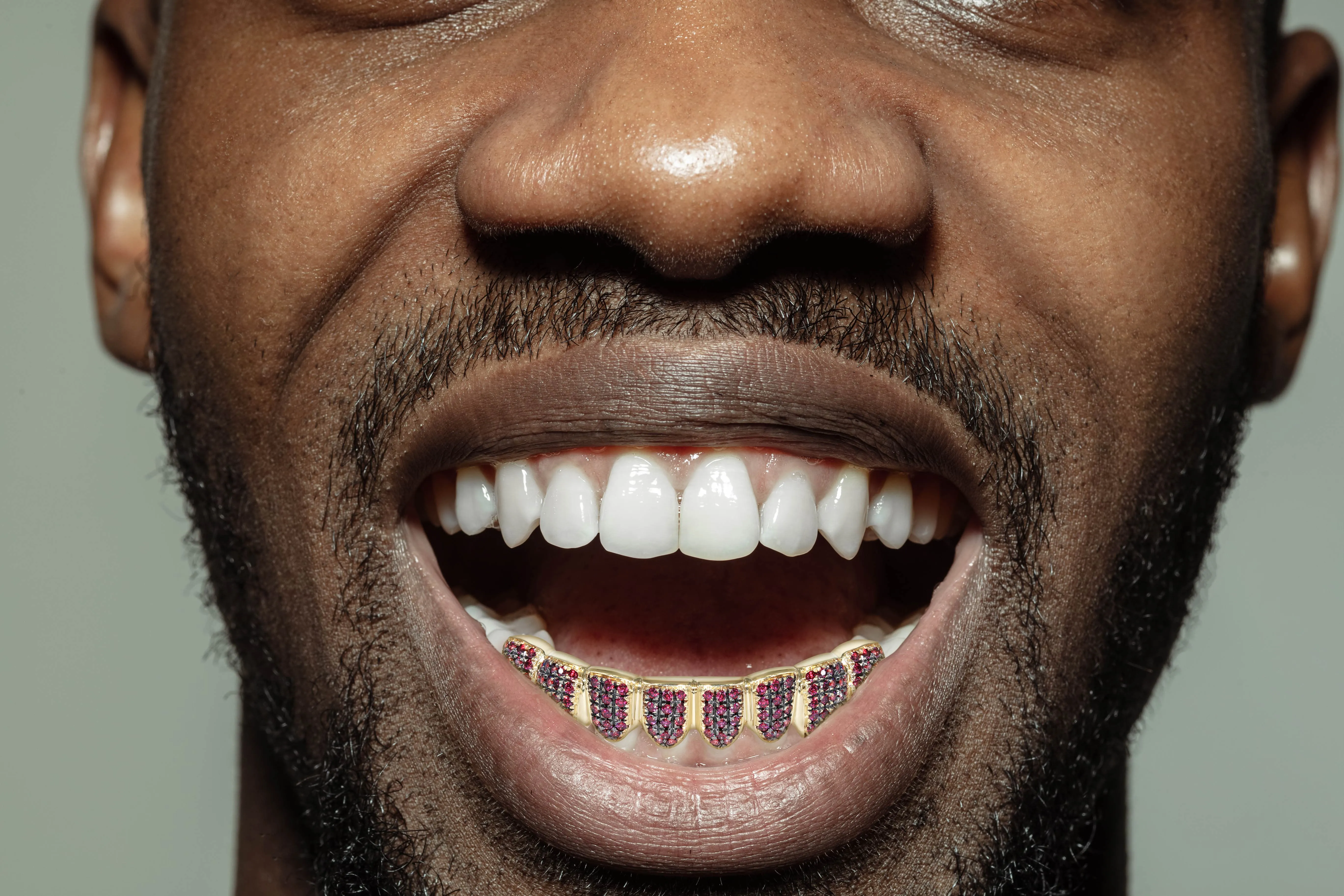 Gold 8 Teeth Ruby Grills